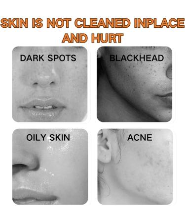 Turmeric Cleaning Soap - Dark Spot Corrector Remover - Natural Soap Bar for Body & Face - Skincare Handmade Soap Bar for Brighten Acne Dark Spots Hyperpigmentation Smooth Skin - Buy Online on GoSupps.com