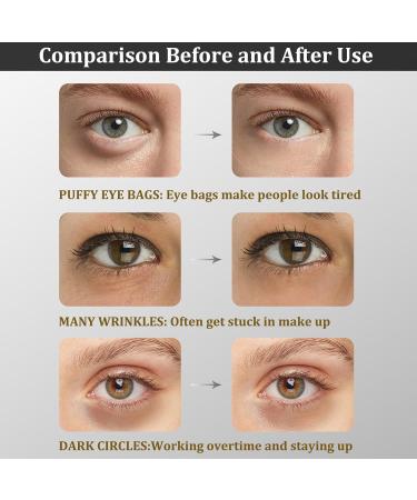 Collagen Under Eye Patches - Dark Circles & Puffy Eyes Treatment - 30 Pairs (Bamboo Charcoal) - Buy Online on GoSupps.com