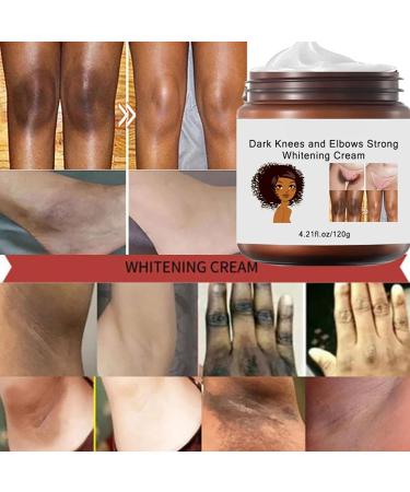 Whitening Cream Underarm Whitening Cream Elbow Private Parts Brightening Cream Bikini And Sensitive Areas Effective For Armpit Knees Elbows & Knuckles Lighten Mela-nin - Buy Online on GoSupps.com
