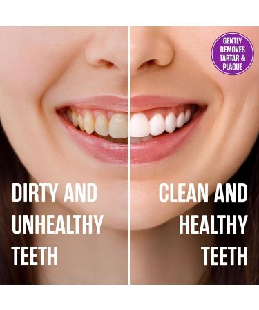 SprinJene Dentifrice naturel sans fluorure pour soulager la sensibilit des dents et des gencives haleine fra che et aide la bouche s che Dentifrice v g talien sans colorant et sans SLS 142 ml - Buy Online on GoSupps.com