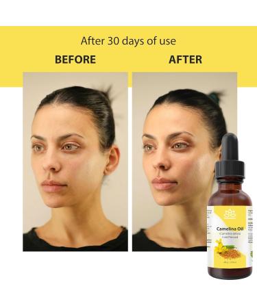 Relaxcation Pure Camelina Oil | Cold Pressed Natural Oil for Face Hair Nails & Body | Lightweight Extract to Promote Elasticity & Softness | Vegan Hexane-Free Unrefined (2 oz) 2 Fl Oz (Pack of 1) - Buy Online on GoSupps.com