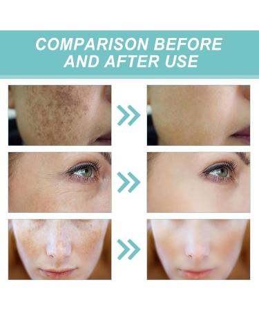  Luthasolic Set of 2 facial cleansing creams freckles brightening cream anti-pigmentation cream for the face - Buy Online on GoSupps.com