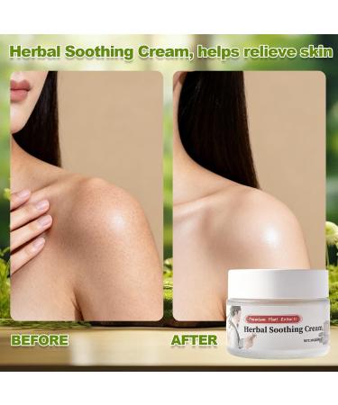 Xaninp Herbal Soothing Relief Cream Herbal Body Care Cream Rich in Calendula Dendrobium Relieves Dry and Tight Skin Itchy Skin 1 FL oz - Buy Online on GoSupps.com