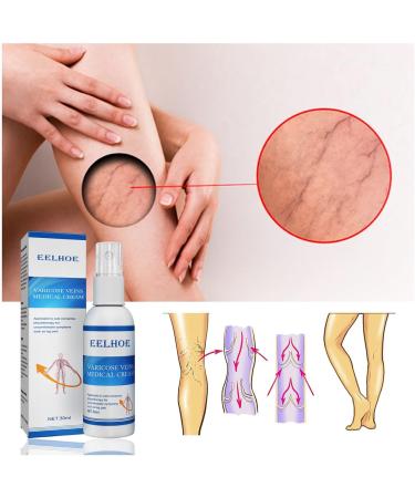 30ml Blood Vein Leg Relief Spray | Promote Circulation & Smooth Veins | Vasculitis Support | Foot Masks & Lipstick Remover | White One Size - Buy Online on GoSupps.com