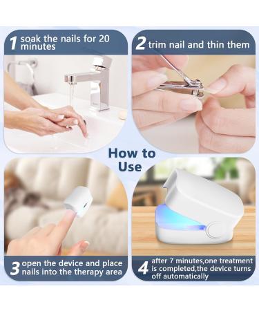 Toenail Fungus Cleaning Device - Heal Discolored & Thick Nails Fast | International Shipping - Buy Online on GoSupps.com