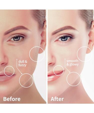 Facial Hair Removal for Women - Painless Electric Razor for Face Lip & Chin | USB Rechargeable Mustache Remover - Buy Online on GoSupps.com