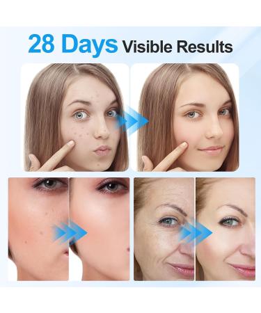 Lovsheme LED Face Mask Light Therapy 7-Color Red Light Therapy for Skin Care Wrinkle Reduction & Skin Rejuvenation Painless Wireless Portable Red Light Therapy Mask for Face Skin Care Home Facial - Buy Online on GoSupps.com