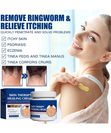 FILFEEL Psoriasis Treatment Cream 2pcs 20g - Soothes Dry Redness and Itchiness - Effective Relief for Skin Psoriasis - Tinea Pedis Corporis Manus - Buy Online on GoSupps.com