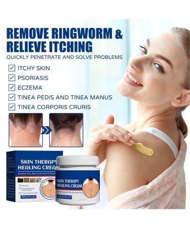 Skin Protectant Psoriasis Relief Cream 2pcs 20g - Soothes Dry, Red, Itchy Skin - Treatment for Tinea Pedis, Corporis, Manus - Buy Online on GoSupps.com