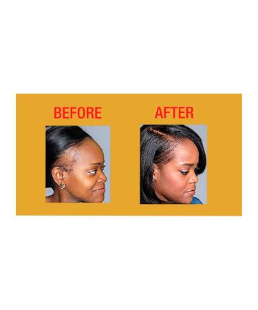 Good2Gro Hair Resuscitator 4oz - Repairs & Restores Hair | Vegan Cruelty-Free Root Activator for Healthy Follicle Growth - Buy Online on GoSupps.com