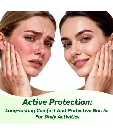 ULARCS Permenthrina Non-Irritating Cream 5% For All Skin Types 1oz - Buy Online on GoSupps.com