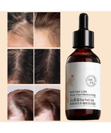  JPSDOWS Anti-hair oil - Anti-hair oil for women 60 ml anti-thinning hair products nourishing and strengthening hair growth oil from Jpsdows plants - Buy Online on GoSupps.com