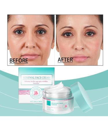 Renewal Face Cream Renewal Face Cream Anti-Wrinkle Facial Cream Brightening Cream Dark Spot Corrector For Face Skin Care Facial Moisturizer Face Cream For All Skin Types (2) - Buy Online on GoSupps.com