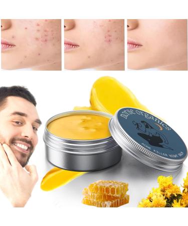 Norse Organic Acne and Redness Relief Balm Norse Organic Acne Care Set Gentle Acne Face Cream Face Balm for Teens and Adults Skin Soothing Cream