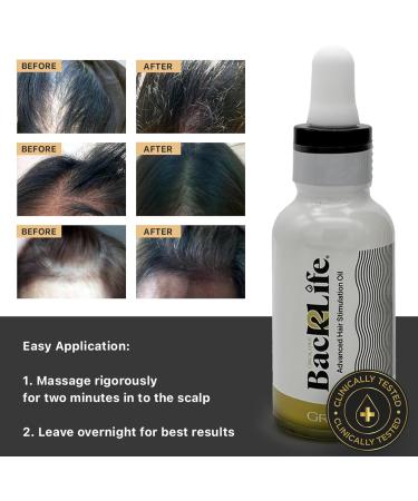 Back2Life 100% Natural Hair Stimulation & Beard Growth Oil - Say Goodbye to Patchy Beards - Moisturizing Serum for Hair & Beard - Scalp Repair & Regrowth Formula - Buy Online on GoSupps.com