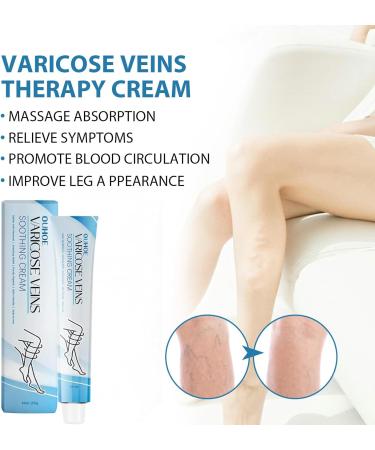 2pcs Varicose Veins Cream Varicose Veins Treatment for Legs Varicose Veins Relief Cream Spider Varicose Cream - Improve Blood Circulation Soothes Tired Legs 2 * 20g - Buy Online on GoSupps.com