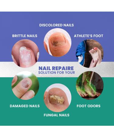 Extra Strength Toenail Treatment - Nail Renewal Repair Solution for Thick Broken & Discolored Nails (1oz) | International Shipping - Buy Online on GoSupps.com