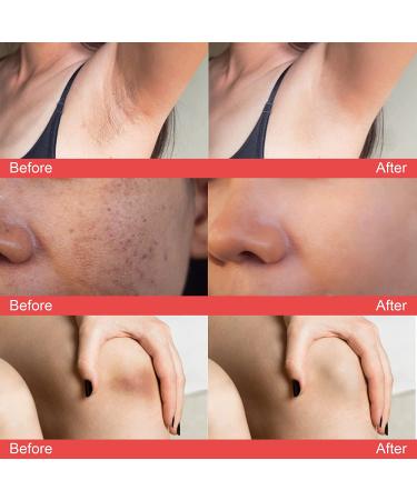 Dark Spot Corrector Cream for Body, Neck, Underarm, Knees, Elbows, Inner Thigh & Private Parts - Upgraded Formula, Quick Results 60ML - Buy Online on GoSupps.com