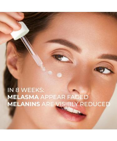 Abera Melasma Serum with Niacinamide & Hyaluronic Acid | Dark Spot Corrector | Melasma Treatment for All Skin Types - Set of 3 (0.68 fl. Oz - Buy Online on GoSupps.com