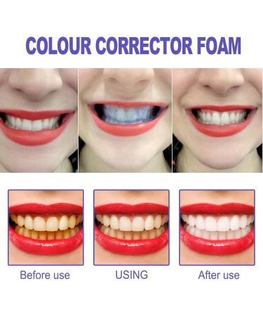 KLYso Foaming Teeth Whitening Toothpaste - Remove Tartar & Stains Freshen Breath Whiten Teeth(2PCS) - Buy Online on GoSupps.com