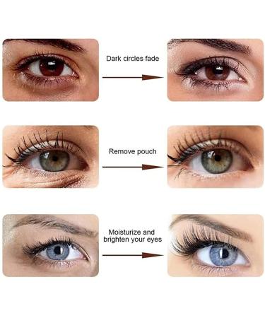 Timeturner 360 Anti Eye Bag Essence - Roll-On Eye Cream for Dark Circles Swelling & Fine Lines (3-Pack) - Cool Tender Formula for Bright Eyes - Buy Online on GoSupps.com