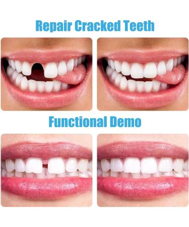 INBOLM Temporary Tooth Filling Repair Kit - DIY Moldable False Teeth Repair Granules - Buy Online on GoSupps.com