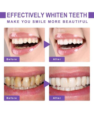 Purple Teeth Whitening Toothpaste | Intensive Stain Removal & Cleansing Paste (2PCs) - Brighten Your Smile Today! - Buy Online on GoSupps.com