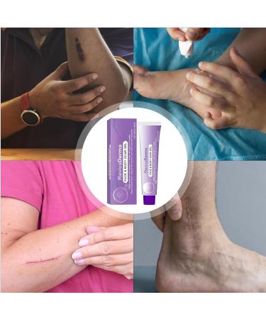 Scar gel for the body 28 gram solution for all skin types smoothing scar angel for the body skin for adults women men teenagers seniors arms legs hands and neck - Buy Online on GoSupps.com
