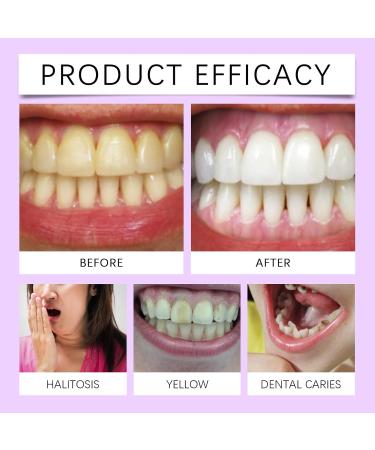 Purple Teeth Cleaning Toothpaste - Gentle Clean Teeth Brightening Fresh Breath Daily Oral Care(1PCS) 1 Fl Oz (Pack of 1) - Buy Online on GoSupps.com