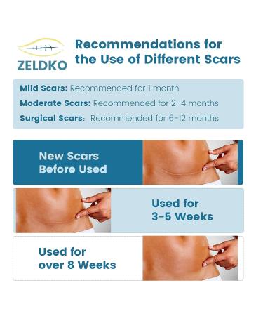 Medical-Grade Silicone Scar Sheets for Surgical Scars, Keloids, and Stretch Marks - 1.6 x 120 inches - Buy Online on GoSupps.com
