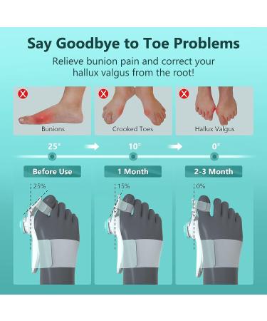 Bunion Corrector for Women Men - Adjustable Splint for Bunion Relief with Toe Separators - Orthopedic Toe Straightener Set - 2 Pairs Silicone Straighteners - 3 Pairs Spacer Included - Buy Online on GoSupps.com