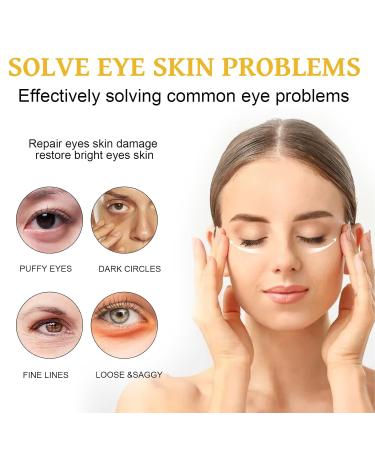 Celyn Eye Cream Celyn Instant Eye Tightener Celyz Eye Repair Cream Celyz Eye Moisturizer Cream Celyz Eye Eye Temporary Eye Tightener (5 Pcs) - Buy Online on GoSupps.com