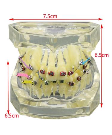 Dental Orthodontic Demonstration Model - Arch Wire Metal Bracket for Teaching & Study (Clear) | International Shipping - Buy Online on GoSupps.com