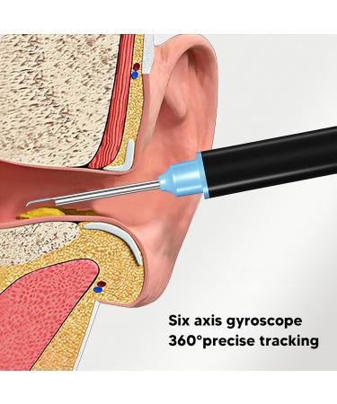 Yuyte Ear Cleaner - 2MP Wax Removal Tool with LED Light 360 Wide-Angle Lens Silicone Tip Dustproof & Waterproof - Buy Online on GoSupps.com