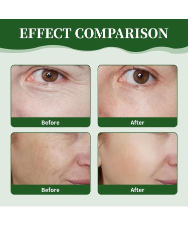 LFCFBH Advanced Firming & Wrinkle-Reducing Cream Multi-purpose Retinol Face & Body Moisturizer Anti-Wrinkle Cream for All Skin - Buy Online on GoSupps.com