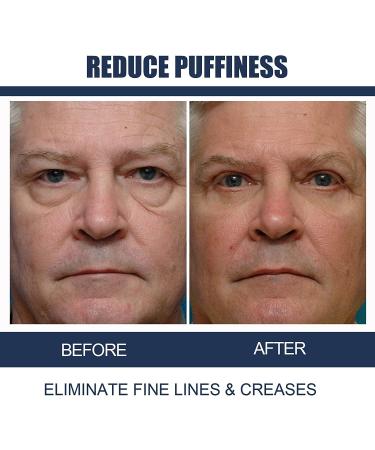 3PCS OPENEYES Awaken Peptide Lifting Eye Gel - Depuffing & Firming Serum for Eye Bags, Dark Circles, and Wrinkles - Buy Online on GoSupps.com