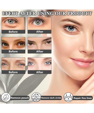 Meanju Eye cream for wrinkles and dark circles with hyaluronic acid antiaging eye care serum for men and women eye cream for dark circles and puffiness - Buy Online on GoSupps.com