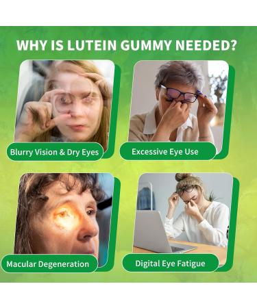 Lutein Gummies 25mg Lutein and Zeaxanthin Supplements Eye Vitamins Gummies for Support Blue Light Protection Vision & Overall Eye Health Sugar Free Pineapple Flavor 60 Count 60 Count (Pack of 1) - Buy Online on GoSupps.com