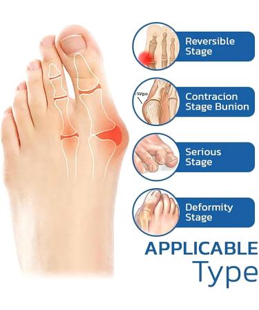 Bunion Relief Socks - Sockalign Projoint AntiBunion Health Socks (5 Pairs) - Buy Online on GoSupps.com