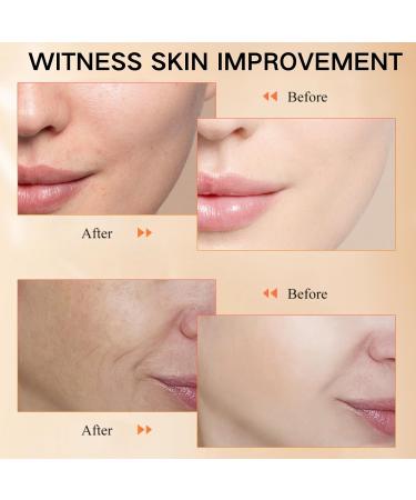 Retinol Serum for Face - Vitamin C Serum - Face Serum for Women - Hydrating Serum for Dark Spots - Anti Aging & Wrinkle Face Serum - Brighten & Plump Skin - Buy Online on GoSupps.com