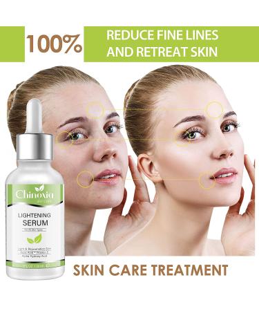 Skin Brightening Serum with Kojic Acid - Dark Spot Corrector for Face & Body - Fade Hyperpigmentation & Melasma - 1 oz (Pack of 2) - Buy Online on GoSupps.com