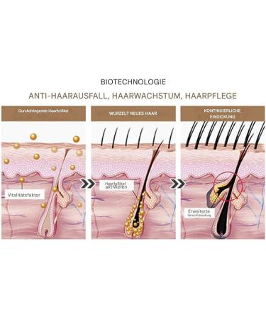  Generisch Scalp Thickening Oil Roller 50ml Scalp and Hair Strengthening Oil | Repair Oil for Damaged Hair Scalp Care Roller Applicator - Buy Online on GoSupps.com