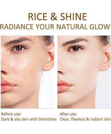 Radiant Rice Water Toner Hydrating Milky Formula with Rice Extract & Purslane | Non-Greasy Purifying & Deeply Hydrating 150 ml | International Shipping Available - Buy Online on GoSupps.com