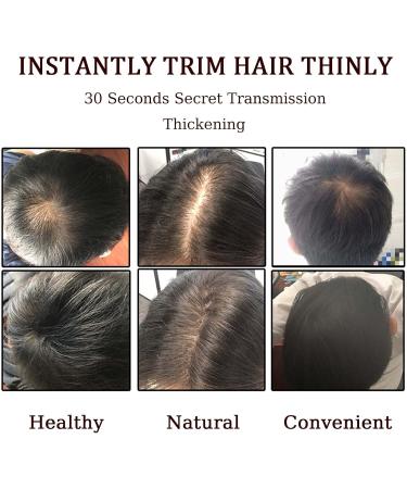 Hair Fibres Dark Brown Hair Volume Powder Natural Formula Hair Thickening Spray Hair Loss Treatment for Men & Women Instantly Conceals Hair Loss Unisex Hair Building Fibres for Bald Spots - Buy Online on GoSupps.com