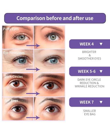 BREYLEE Retinol Eye Cream - Puffy Eyes and Dark Circles Treatment for Youthful Skin - 0.70 Fl Oz - Buy Online on GoSupps.com