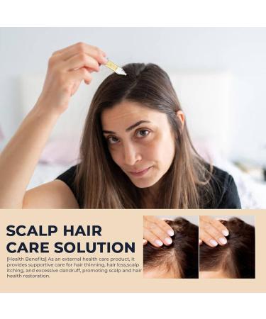 Solution de croissance des cheveux formule de soutien du cuir chevelu rem de avec m lange anti-d mangeaisons liquide de soin avec complexe botanique nourrissant incontournable de beaut pour femm 1 ml (Lot de 1) - Buy Online on GoSupps.com