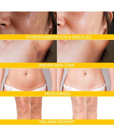 Dark Spot Remover Cream for Face & Body - Ashania 2 FL OZ/60ML - Buy Online on GoSupps.com