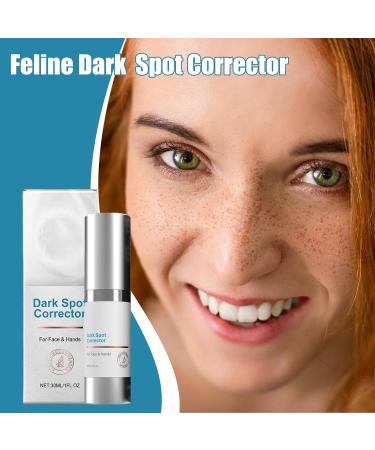 Fenayuu Dark Spot Correction Brightening Dark Spot Correction for Face and Body 30ml Effective Moisturizer for Face Armpits and Legs All Skin Types - Buy Online on GoSupps.com