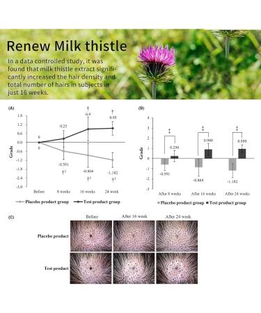 Scalp Serum for Hair Growth - Boost Density & Volume in 12 Weeks | Hair Loss Solution for Men & Women - Buy Online on GoSupps.com