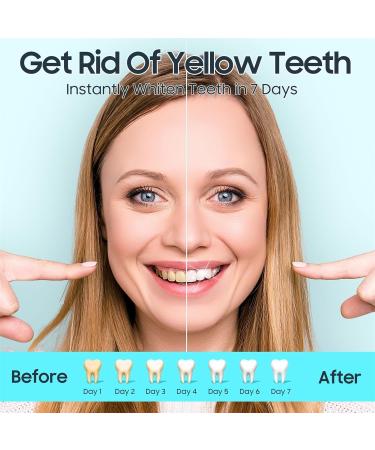Whitening Strips for Sensitive Teeth - 28 Effective Tooth White Strips to Remove Stains from Smoking Coffee Soda & Wine - Buy Online on GoSupps.com
